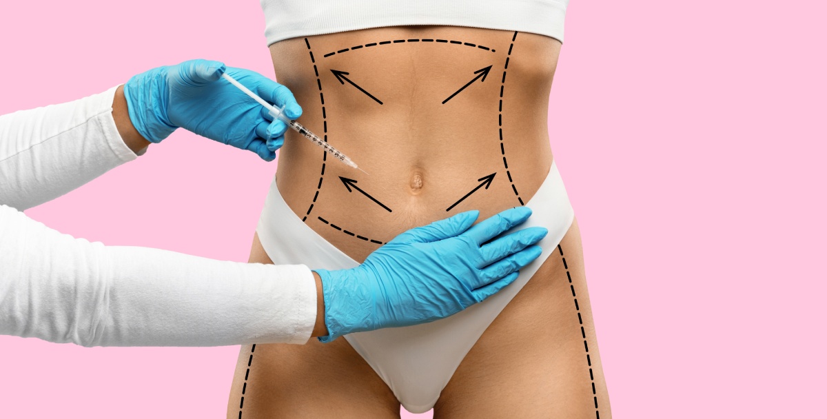 non-surgical body lifting 