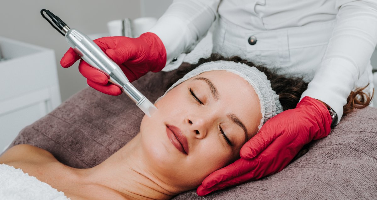 beautiful woman receiving microneedling rejuvenation treatment