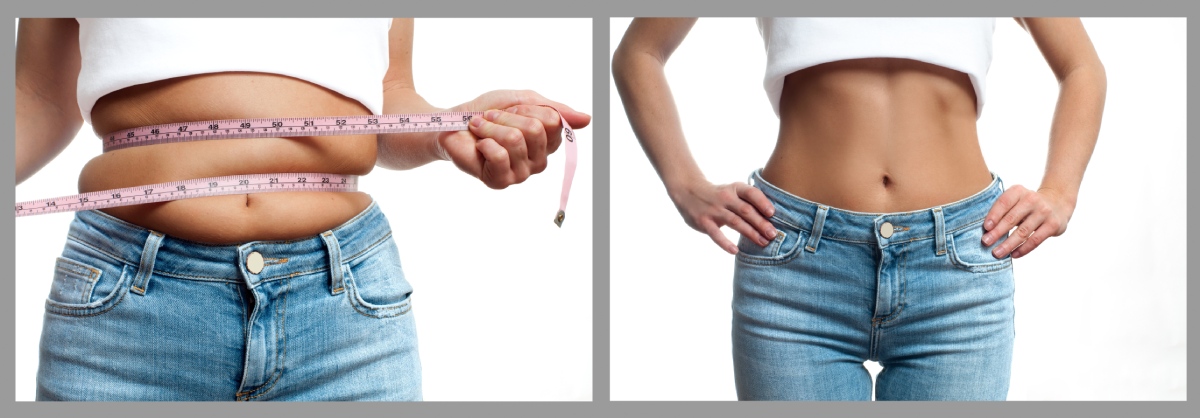 female body before and after weight loss